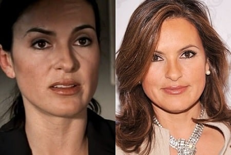 A before and after picture of Mariska Hargitay.